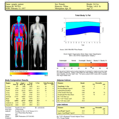 Screenshot of Hologic DEXA body composition results displaying detailed breakdowns of fat mass, lean muscle, and bone density used for precise health and fitness tracking in Kelowna.